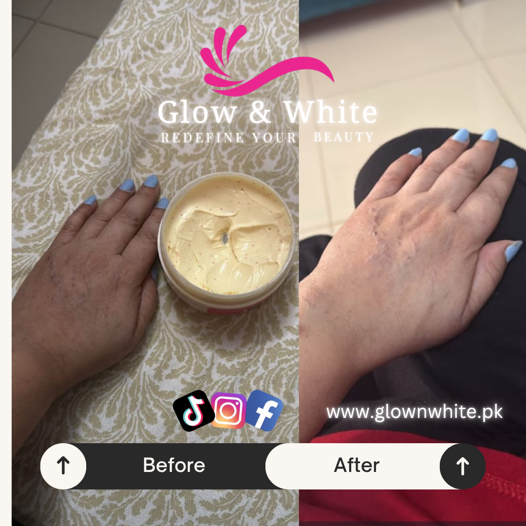 Glow & White  (HAND & FOOT CARE)
