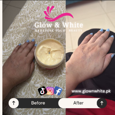 Glow & White  (HAND & FOOT CARE)