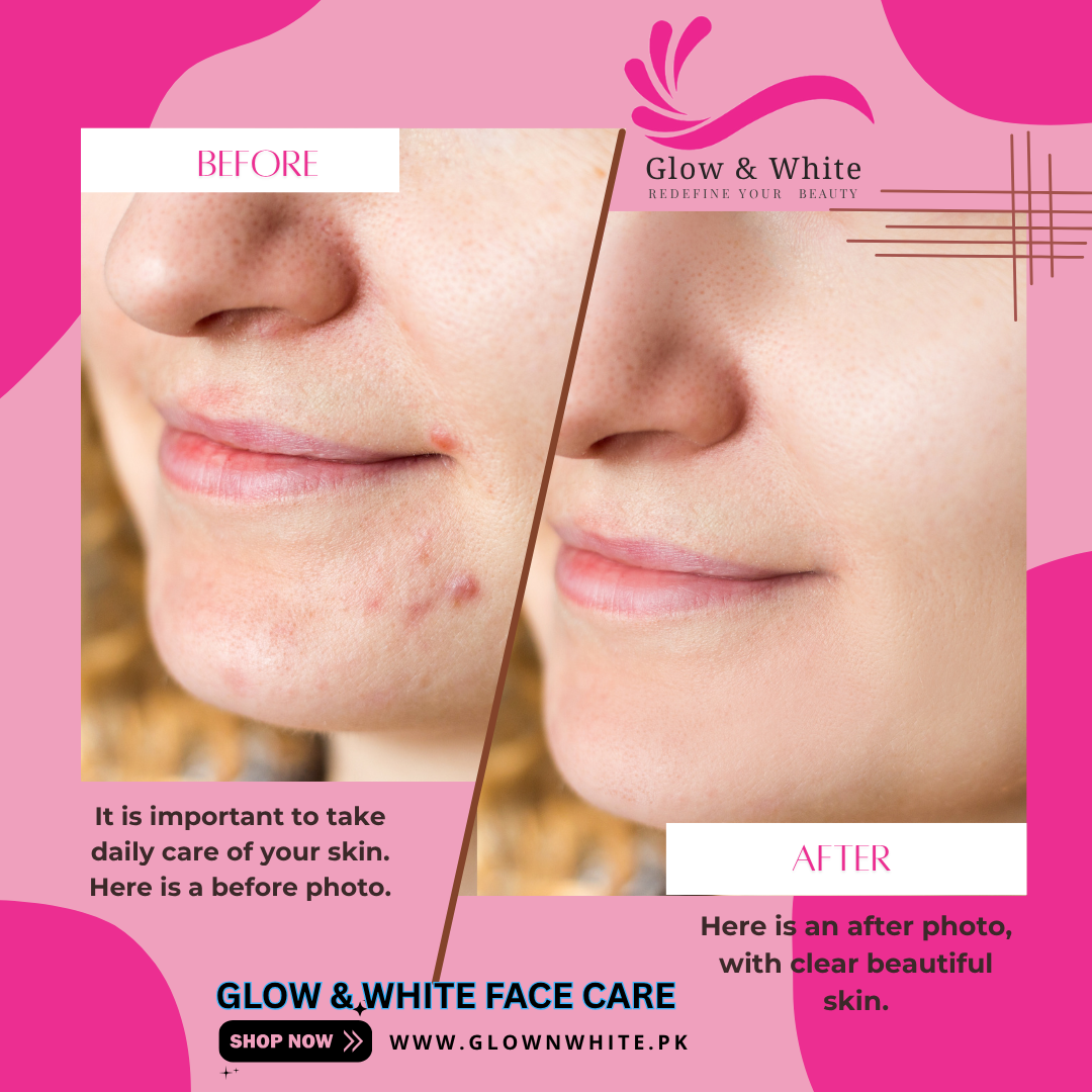 Glow & White (FACE CARE)